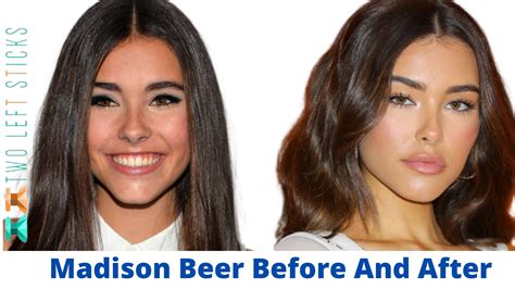 madison beer plastic sugery|Madison Beer Plastic Surgery: Quotes, Before, After。